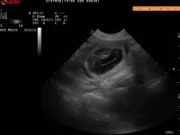 13 maart 2018 – we zijn weer zwanger maar ook verdrietig